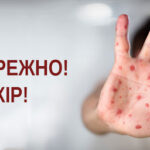 ОБЕРЕЖНО, КІР!