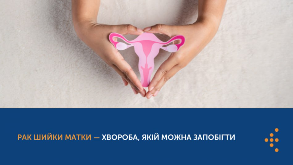 Що таке рак шийки матки?